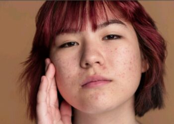 Yuk Basmi Jerawat dengan Nacific Acne Cica Plus, Dapatkan Segera di Blibli!